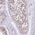 COX17 Antibody in Immunohistochemistry (Paraffin) (IHC (P))