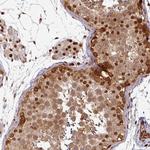 SIK3 Antibody in Immunohistochemistry (Paraffin) (IHC (P))