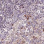 APOA1BP Antibody in Immunohistochemistry (IHC)
