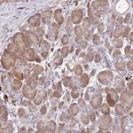 CCDC140 Polyclonal Antibody