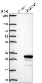 CCDC140 Antibody in Western Blot (WB)