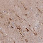 SPHKAP Antibody in Immunohistochemistry (IHC)