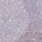 SPHKAP Antibody in Immunohistochemistry (IHC)