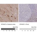 SPHKAP Antibody
