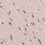 TBC1D2B Polyclonal Antibody