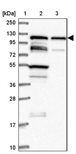 TBC1D2B Antibody in Western Blot (WB)