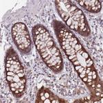 ADAL Polyclonal Antibody