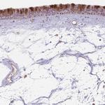 CCDC168 Polyclonal Antibody