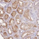 SLC35F2 Polyclonal Antibody