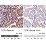 DAK Antibody in Immunohistochemistry (IHC)