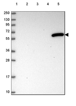 DAK Antibody in Western Blot (WB)