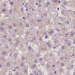 ACY3 Antibody in Immunohistochemistry (IHC)