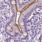 ACY3 Antibody in Immunohistochemistry (IHC)