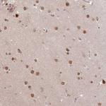 HAUS3 Polyclonal Antibody