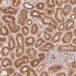 C18orf14 Polyclonal Antibody