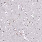 GLCE Polyclonal Antibody