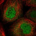 GLYR1 Polyclonal Antibody