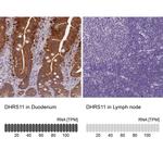 DHRS11 Polyclonal Antibody