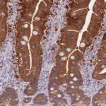 DHRS11 Antibody in Immunohistochemistry (IHC)