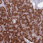 AP5S1 Antibody in Immunohistochemistry (Paraffin) (IHC (P))