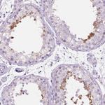 PDCL2 Polyclonal Antibody