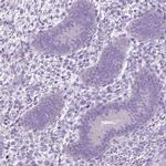PDCL2 Antibody in Immunohistochemistry (IHC)