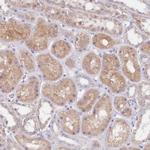 FTSJD1 Antibody in Immunohistochemistry (Paraffin) (IHC (P))