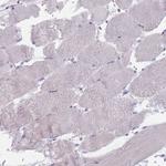 FTSJD1 Antibody in Immunohistochemistry (Paraffin) (IHC (P))
