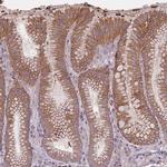 HSBP1L1 Antibody in Immunohistochemistry (IHC)