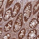 GGA1 Antibody in Immunohistochemistry (Paraffin) (IHC (P))