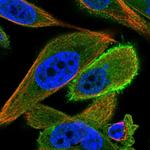 C3orf14 Polyclonal Antibody