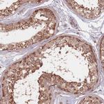 C3orf14 Antibody in Immunohistochemistry (Paraffin) (IHC (P))