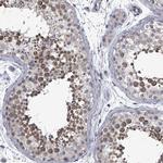 PTPN20A Polyclonal Antibody