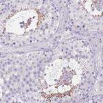 TCP11 Polyclonal Antibody