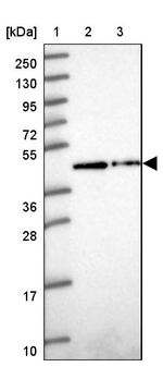 ZNF852 Antibody in Western Blot (WB)