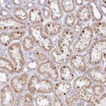 MAZ Antibody in Immunohistochemistry (IHC)