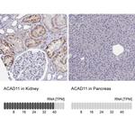 ACAD11 Polyclonal Antibody