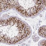 KIAA1210 Polyclonal Antibody