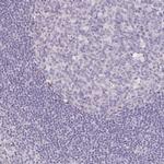 KIAA1210 Antibody in Immunohistochemistry (IHC)