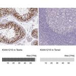 KIAA1210 Antibody