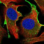 CTDSPL Polyclonal Antibody