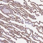 CTDSPL Antibody in Immunohistochemistry (Paraffin) (IHC (P))
