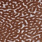 ZNF140 Polyclonal Antibody