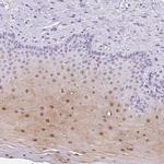 SERPINB4 Polyclonal Antibody