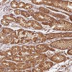 Adenylate Cyclase 4 Antibody in Immunohistochemistry (Paraffin) (IHC (P))