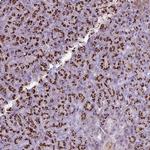 FAM43A Antibody in Immunohistochemistry (Paraffin) (IHC (P))