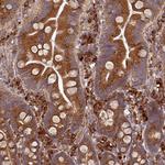 EDEM2 Polyclonal Antibody