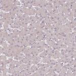 SLC26A6 Antibody in Immunohistochemistry (Paraffin) (IHC (P))