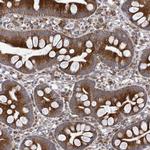 SAR1B Polyclonal Antibody