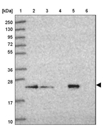 SAR1B Antibody in Western Blot (WB)